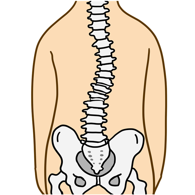側弯症は、脊柱が弯曲や回旋した状態で、腰痛や神経痛、脊柱管狭窄や圧迫骨折などの問題にも繋がる