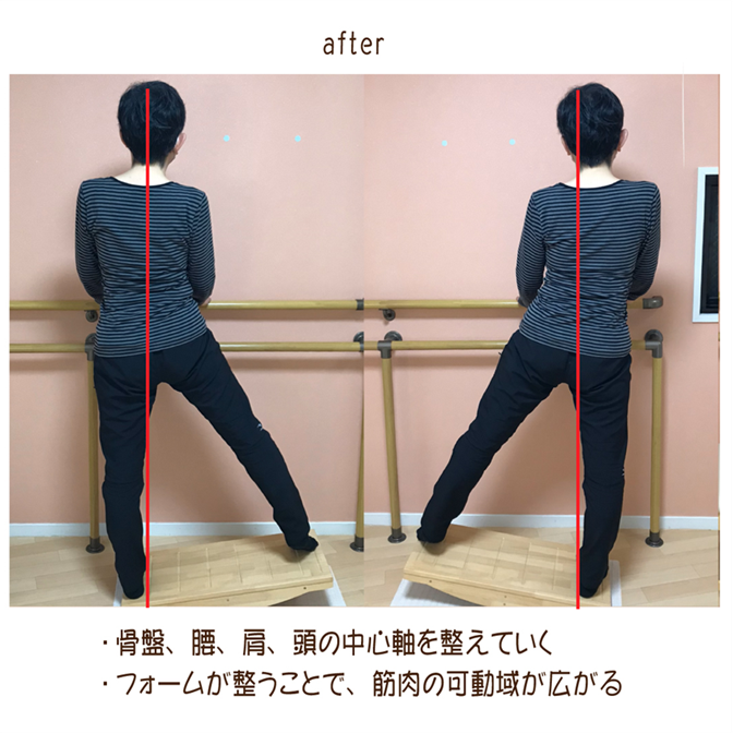 左右に体重移動したときに、ズレていた中心軸を整えて側弯症をなおす、日本初の運動療法