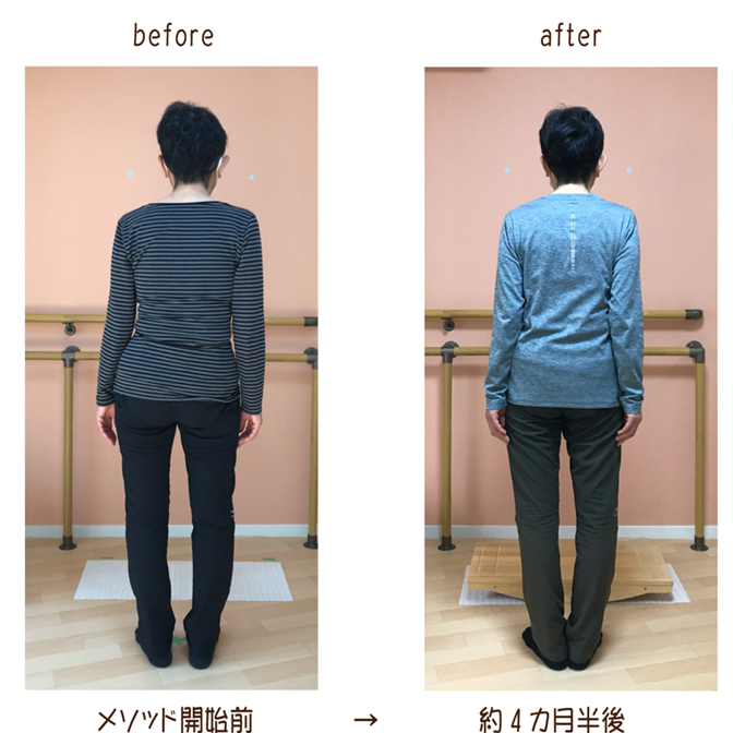 日本初の側弯症もなおす姿勢改善メソッドで、骨格が整えば、筋肉を大きなつながりでトレーニングできる