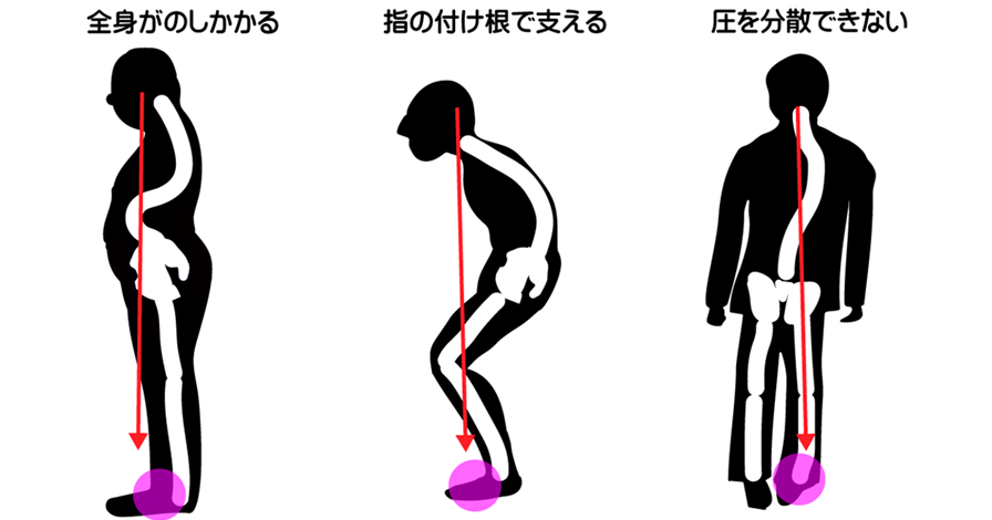 足に厚みがあり硬い姿勢、指の付け根で支える姿勢、片側の圧を分散できない姿勢は、正しい姿勢に改善が必要