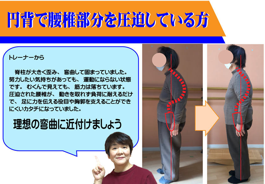 日本初側弯症をなおす運動療法は、シニアの円背やスウェイバック姿勢も整えて歩行、姿勢を改善する